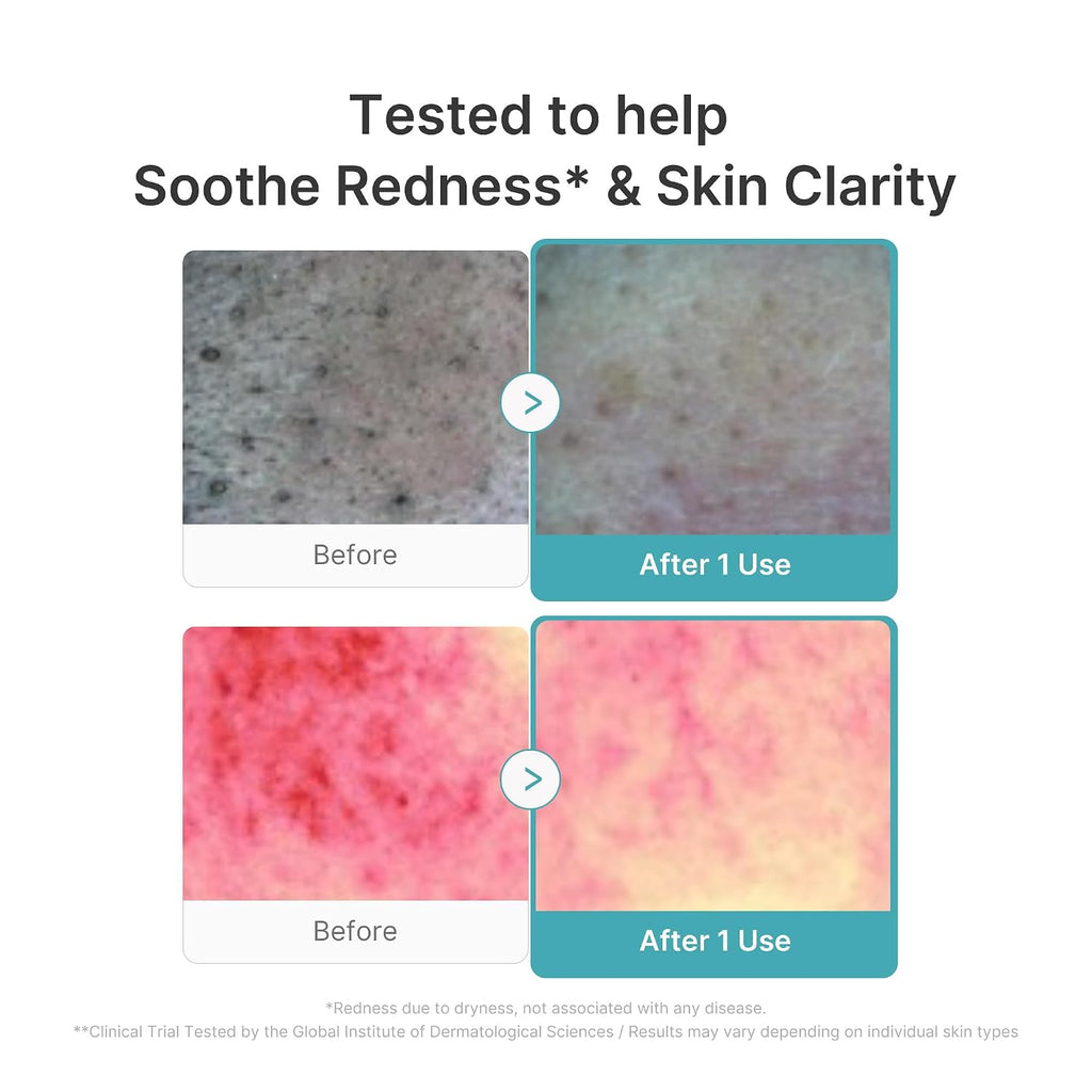medicube Facial Cleanser Zero Pore Capsule Foam Cleanser