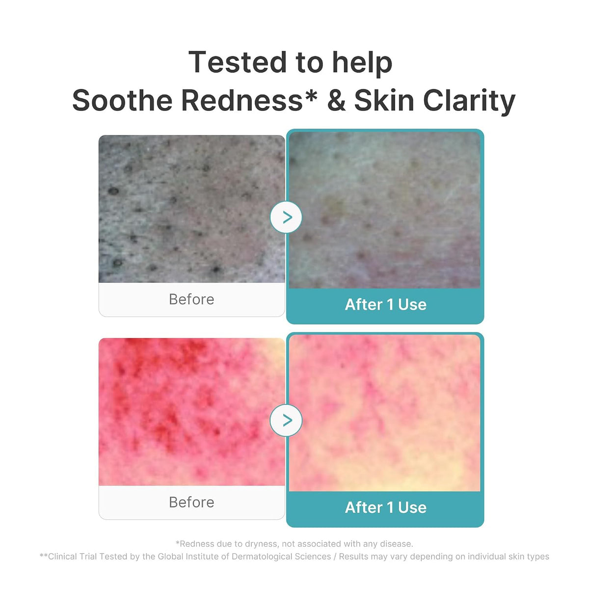 medicube Facial Cleanser Zero Pore Capsule Foam Cleanser